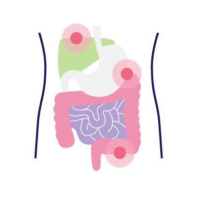 gastrointestinal-cancer
